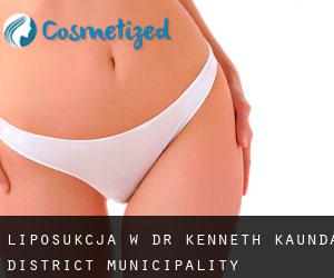 Liposukcja w Dr Kenneth Kaunda District Municipality