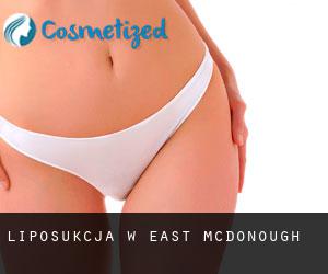 Liposukcja w East McDonough