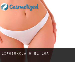 Liposukcja w El Loa