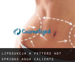 Liposukcja w Fetters Hot Springs-Agua Caliente