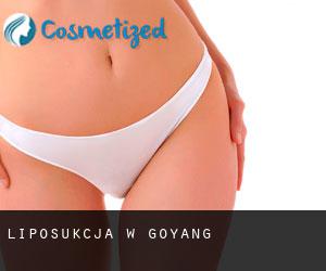 Liposukcja w Goyang