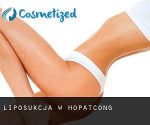 Liposukcja w Hopatcong