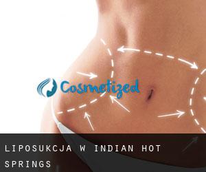 Liposukcja w Indian Hot Springs