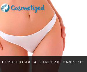 Liposukcja w Kanpezu / Campezo