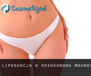 Liposukcja w Koshkonong Mounds