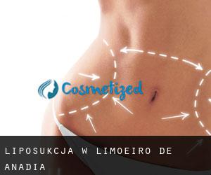 Liposukcja w Limoeiro de Anadia
