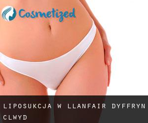 Liposukcja w Llanfair-Dyffryn-Clwyd