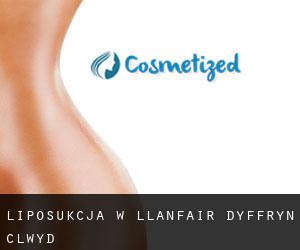 Liposukcja w Llanfair-Dyffryn-Clwyd