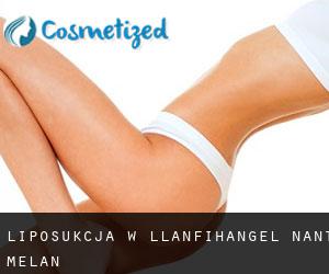Liposukcja w Llanfihangel-nant-Melan