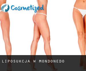 Liposukcja w Mondoñedo