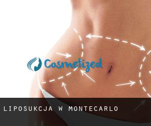 Liposukcja w Montecarlo