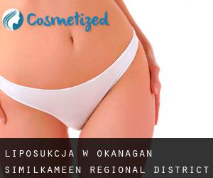 Liposukcja w Okanagan-Similkameen Regional District