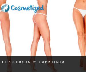 Liposukcja w Paprotnia