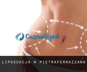 Liposukcja w Pietraferrazzana