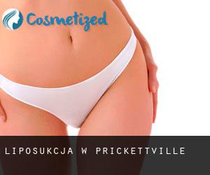 Liposukcja w Prickettville
