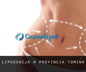 Liposukcja w Provincia Tomina