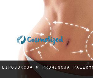 Liposukcja w Prowincja Palermo