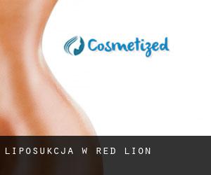 Liposukcja w Red Lion