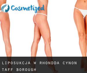 Liposukcja w Rhondda Cynon Taff (Borough)