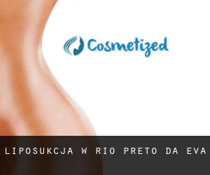 Liposukcja w Rio Preto da Eva