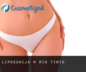 Liposukcja w Rio Tinto