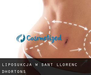 Liposukcja w Sant Llorenç d'Hortons
