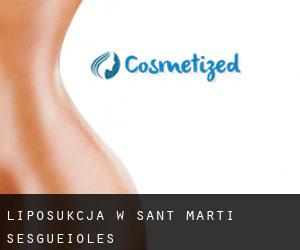 Liposukcja w Sant Martí Sesgueioles