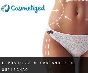 Liposukcja w Santander de Quilichao