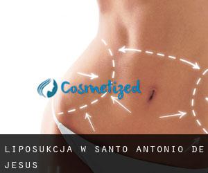 Liposukcja w Santo Antônio de Jesus