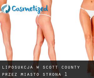 Liposukcja w Scott County przez miasto - strona 1