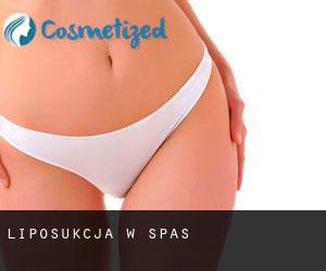 Liposukcja w Spas