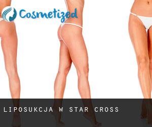 Liposukcja w Star Cross