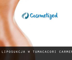 Liposukcja w Tumacacori-Carmen