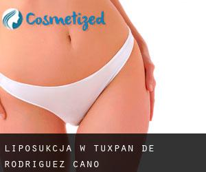 Liposukcja w Tuxpan de Rodríguez Cano