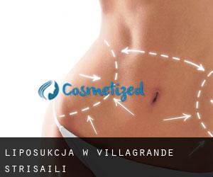 Liposukcja w Villagrande Strisaili