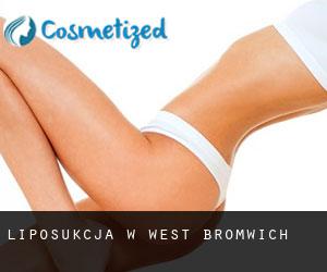 Liposukcja w West Bromwich