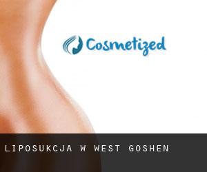 Liposukcja w West Goshen