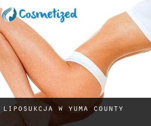 Liposukcja w Yuma County