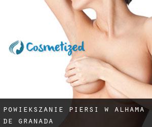 Powiększanie piersi w Alhama de Granada