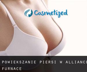 Powiększanie piersi w Alliance Furnace