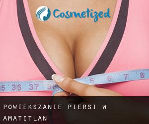 Powiększanie piersi w Amatitlán