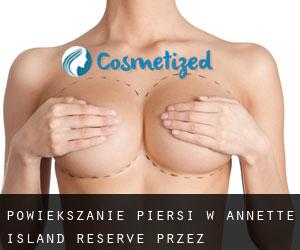 Powiększanie piersi w Annette Island Reserve przez najbardziej zaludniony obszar - strona 1