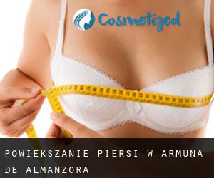 Powiększanie piersi w Armuña de Almanzora