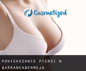 Powiększanie piersi w Barrancabermeja