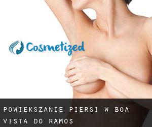 Powiększanie piersi w Boa Vista do Ramos