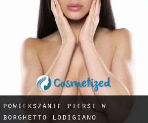 Powiększanie piersi w Borghetto Lodigiano