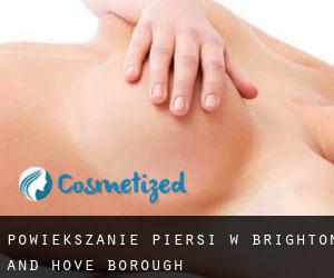 Powiększanie piersi w Brighton and Hove (Borough)