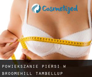 Powiększanie piersi w Broomehill-Tambellup