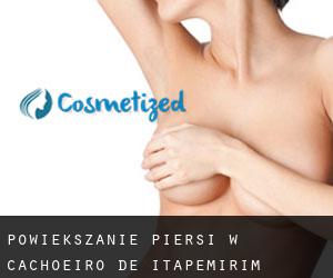 Powiększanie piersi w Cachoeiro de Itapemirim