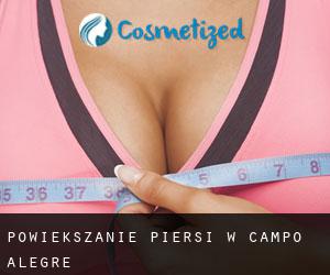 Powiększanie piersi w Campo Alegre